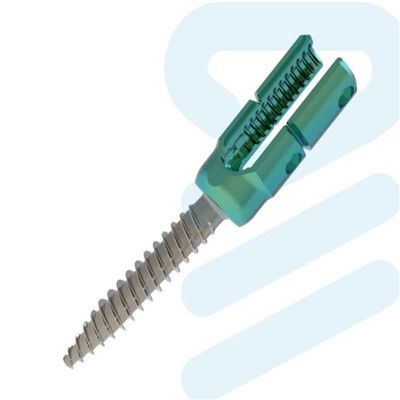 5.5 6.0 मिमी आंतरिक स्पाइनल फिक्सेशन इम्प्लांट