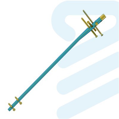 टाइटेनियम इंट्रामेडुलरी नेल